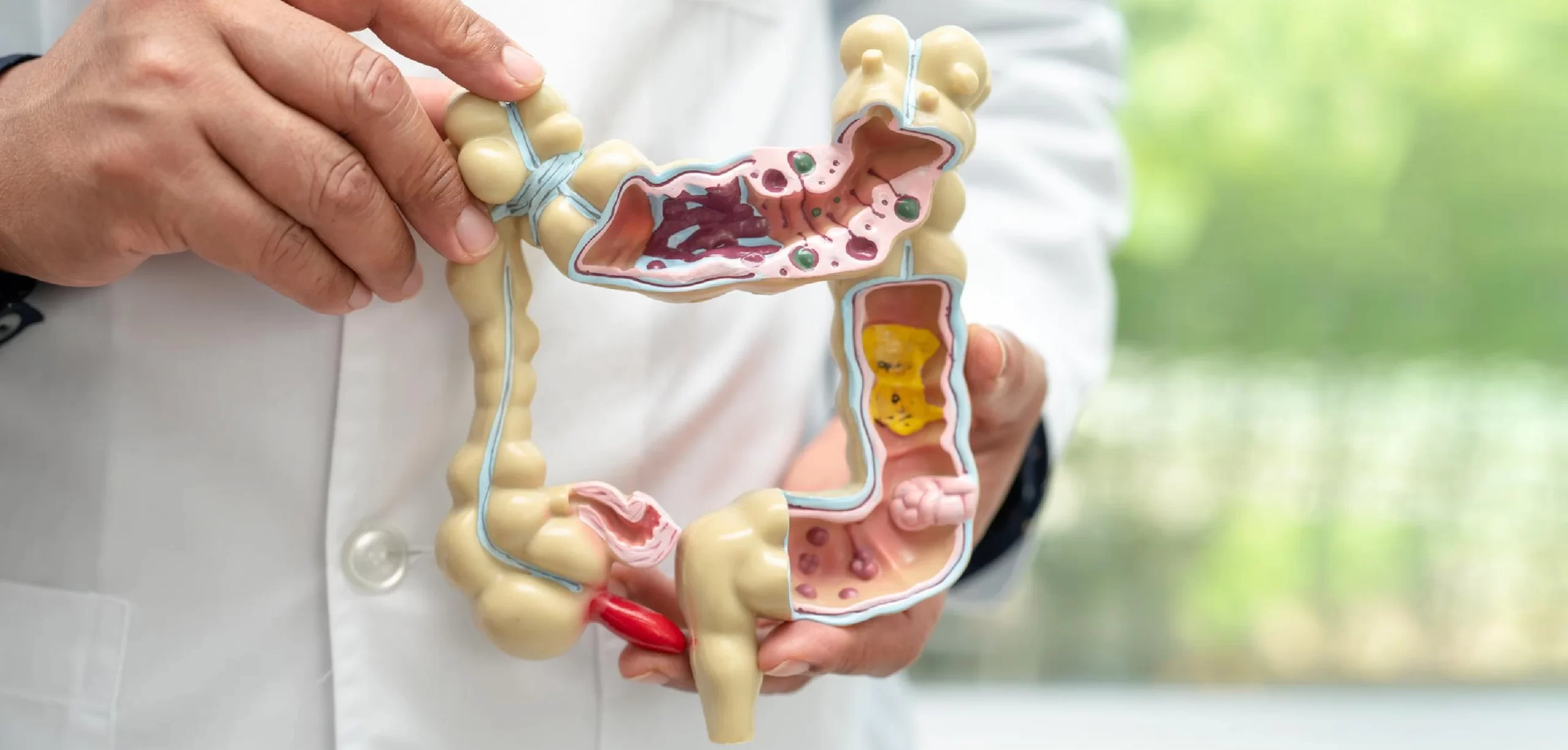 664dc624f2ebfBanner__Colorectal Cancer