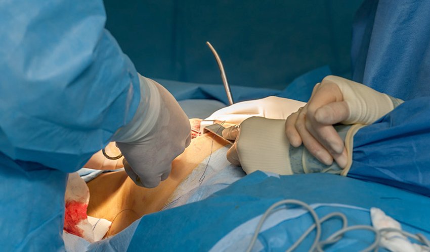 breast-cancer-surgery