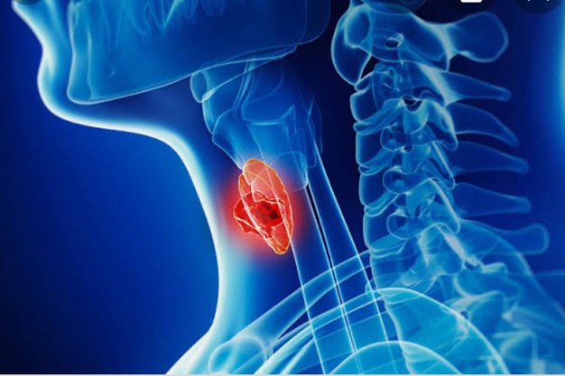 Head and Neck Cancer Surgeon in Aurangabad